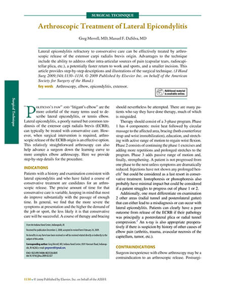 Arthroscopic Treatment of Lateral Epicondylitis